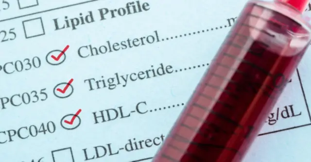 Cholesterin-Grenzwerte?